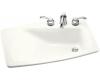 Kohler Lady Vanity K-2170-1-0 White Self-Rimming Lavatory with Single-Hole Faucet Drilling