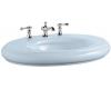 Kohler Revival K-2001-1-6 Skylight Lavatory Basin with Single-Hole Faucet Drilling