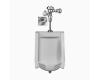Sloan 10001304 WEUS-1000.1304 Su-1009 Standard Urinal & Royal 186 Ess Tmo Flushometer Sloan 10001304 WEUS-1000.1304 Su-1009 Standard Urinal & Royal 186 Ess Tmo Flushometer